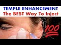 Temple Enhancement Cannula Injection with Dr. Steven Weiner "The Cannula Doc"