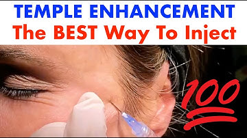 Temple Enhancement Cannula Injection with Dr. Steven Weiner "The Cannula Doc"