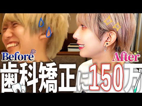 【元出っ歯】整形依存症アイドルが語る歯科矯正