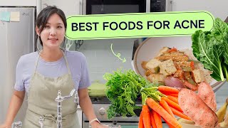 Best & Worst Foods for Acne + 3 Simple Recipes | Acne School EP04 Home Economics