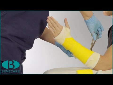 Video: Gebarsten benen behandelen (stressfracturen) - Ajarnpa