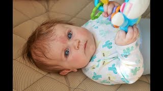 Por qué algunos bebés nacen con una mancha roja en la frente