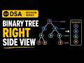 Binary Tree Right Side View | Leetcode | DSA Revision Series