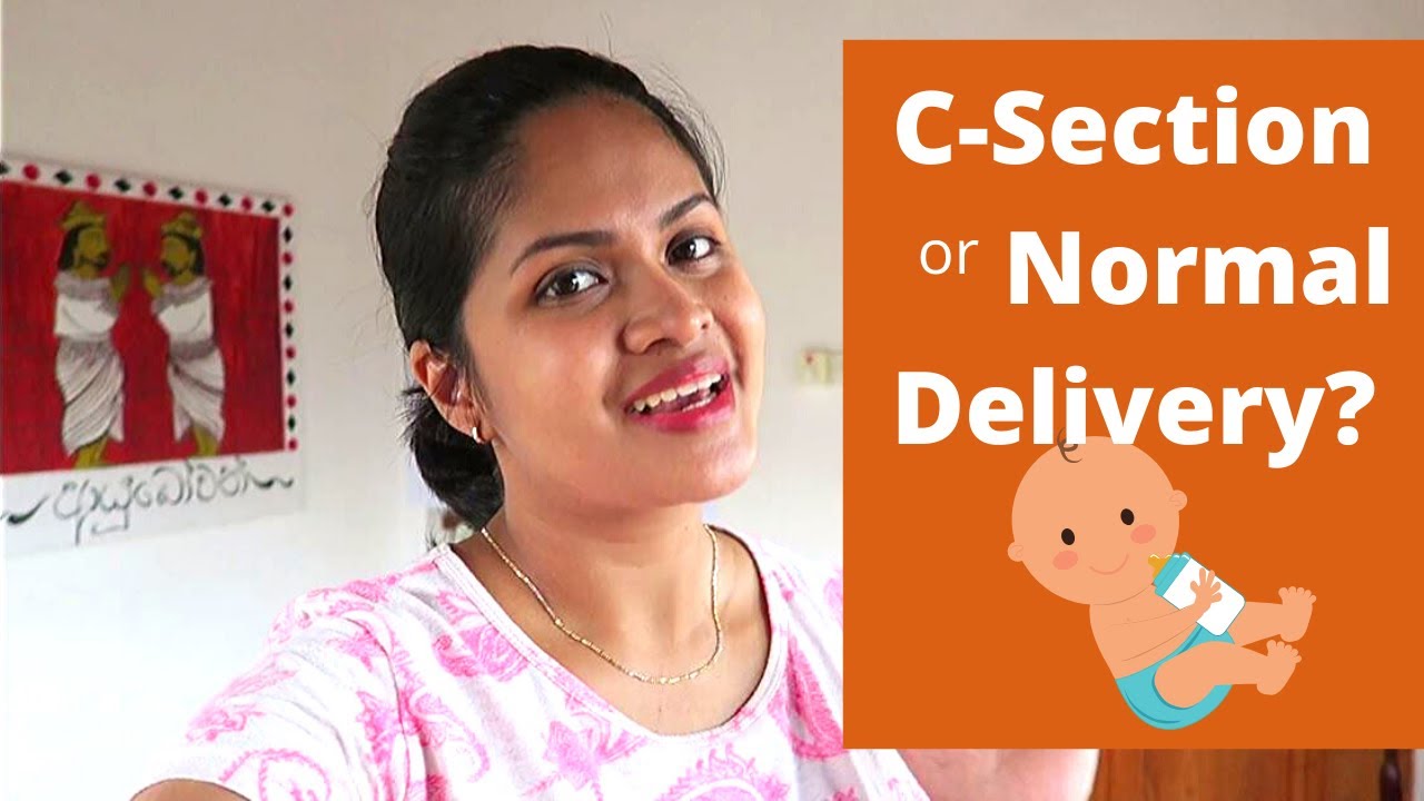  C section Vs Normal Delivery 