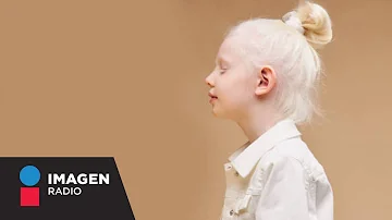 ¿Qué gen causa el albinismo?