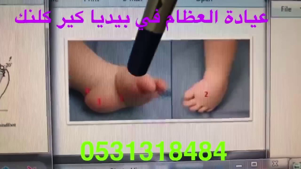 القدم الحنفاء