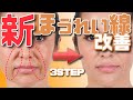 【最新版】ほうれい線を消す方法!たるみも根こそぎ改善【リニューアルVer】