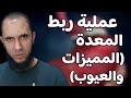 عملية ربط المعدة للتخسيس المميزات والعيوب د أحمد رجب 
