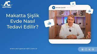 Makatta Şi̇şli̇k Evde Nasil Tedavi̇ Edi̇li̇r?