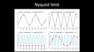 Principles of Doppler Ultrasound
