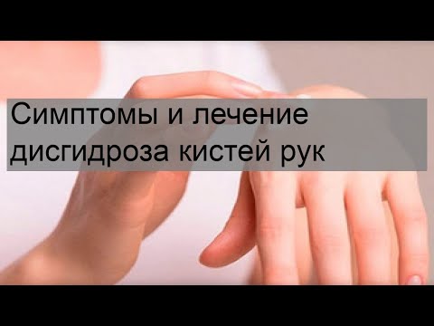 Симптомы и лечение дисгидроза кистей рук