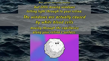 Michael Mauser: What are those floaty things in your eye?