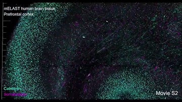 Technologies enable 3D imaging of whole human brain hemispheres at subcellular resolution