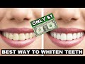 How to whiten teeth at home