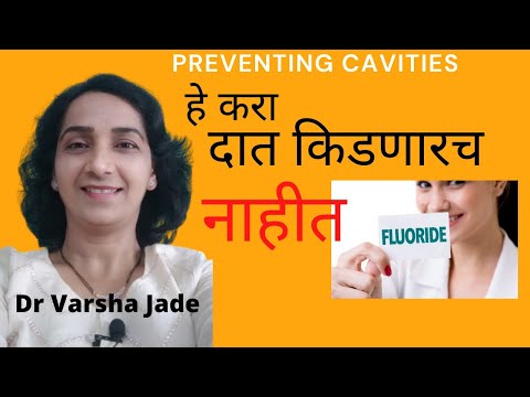 दात किडणारच नाहीत|हे करा दात किडणारच नाहीत|दातांची कीड टाळता येते|Fluoride gel application|Fluorosis