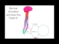 How Does Spinal Cord Injury Effect the Bladder?