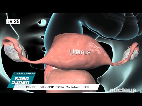 რას გვირჩევენ ექიმები - ონკო გინეკოლოგია და სკრინინგი