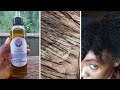 GET rid of DANDRUFF/ITCHY SCALP | Stimulate natural hai growth with this Anti itch/dandruff hair oil