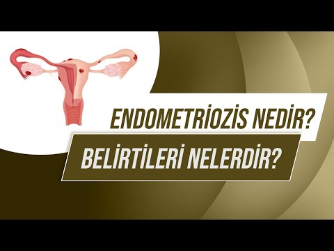 Video: Endometriozis Belirtilerini Tanımanın 3 Yolu