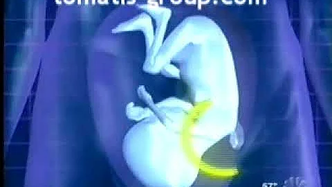 [EN] Re-educating the hearing - The Tomatis Method