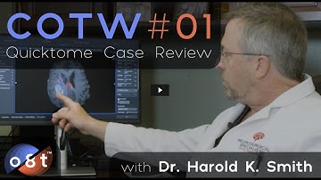 Connectome of the Week (COTW) Episode 01: Right Parietal Glioma