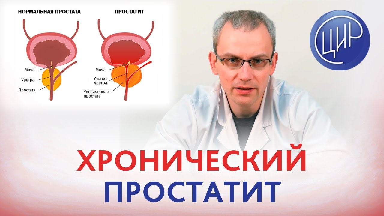 Хронический бактериальный простатит - причина биохимической беременности и анэмбрионии? Живулько А.Р