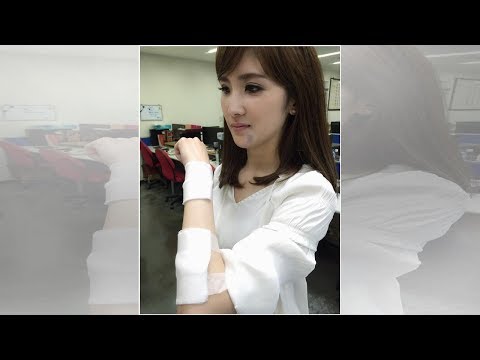 中視主播驚傳車禍 臉部身體多處擦傷