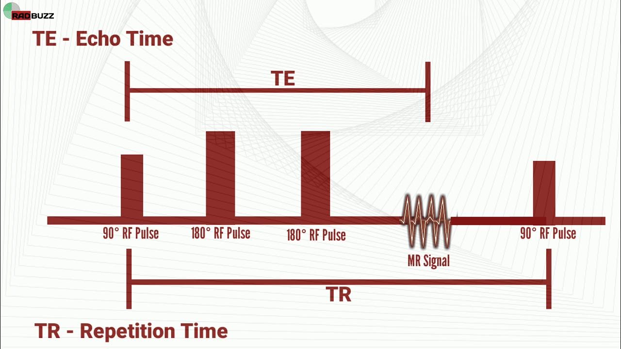 Iperintensità Nelle Sequenze A Tr Lungo What is TE and TR in MRI? - YouTube