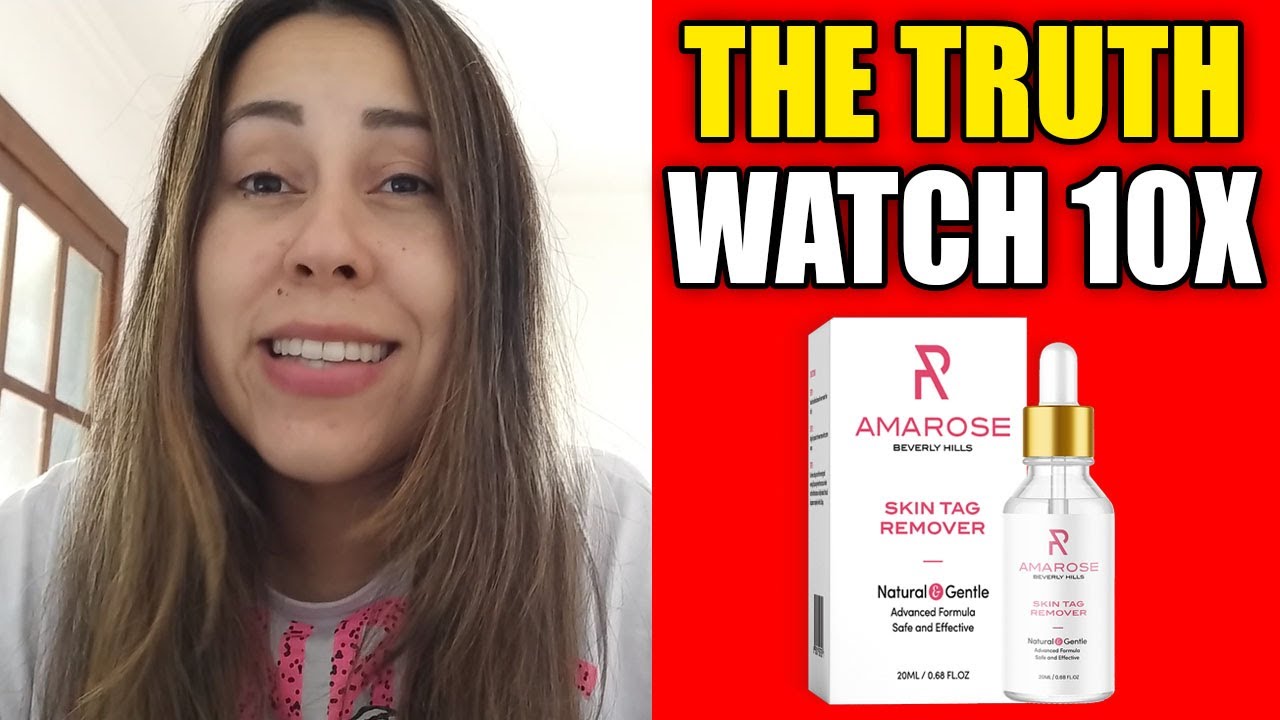 WARNING Amarose Skin Tag Remover Review THE TRUTH Does Amarose Skin warning-amarose-skin-tag-remover-review-the-truth-does-amarose-skin