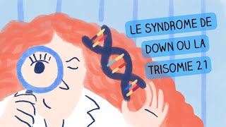 Trisomie 21 ou Syndrome de Down, - Mécanismes génétiques