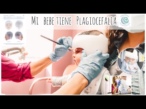 Vídeo: ¿Por Qué Los Bebés Usan Cascos? Preguntas Frecuentes Sobre La Terapia Con Casco Médico