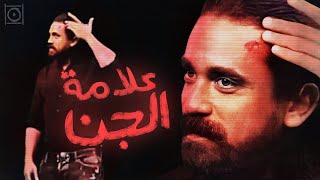 علامة الجن على وجه أمير كرارة !