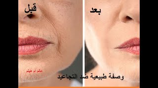 وصفة طبيعية ضد التجاعيد : Natural anti-wrinkle recipe