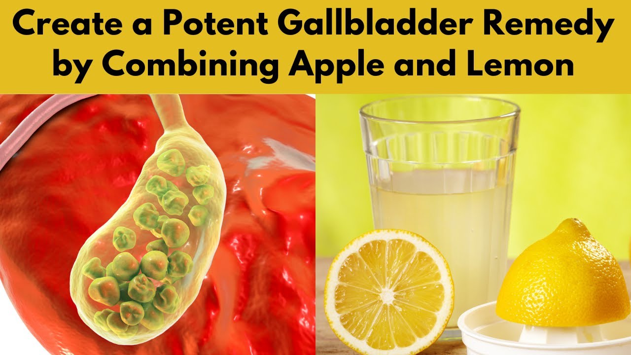 Create a Potent Gallbladder Remedy by Combining Apple and Lemon YouTube