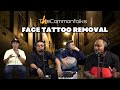 Face tattoo removal ep 345