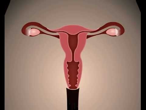 PROSES TERJADINYA MENSTRUASI