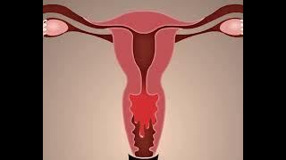 PROSES TERJADINYA MENSTRUASI