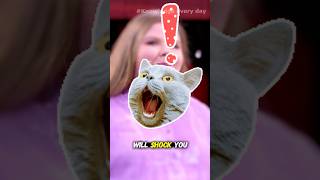 Shocking Super-Sized Tongue! 😱 | What is Macroglossia?#shorts