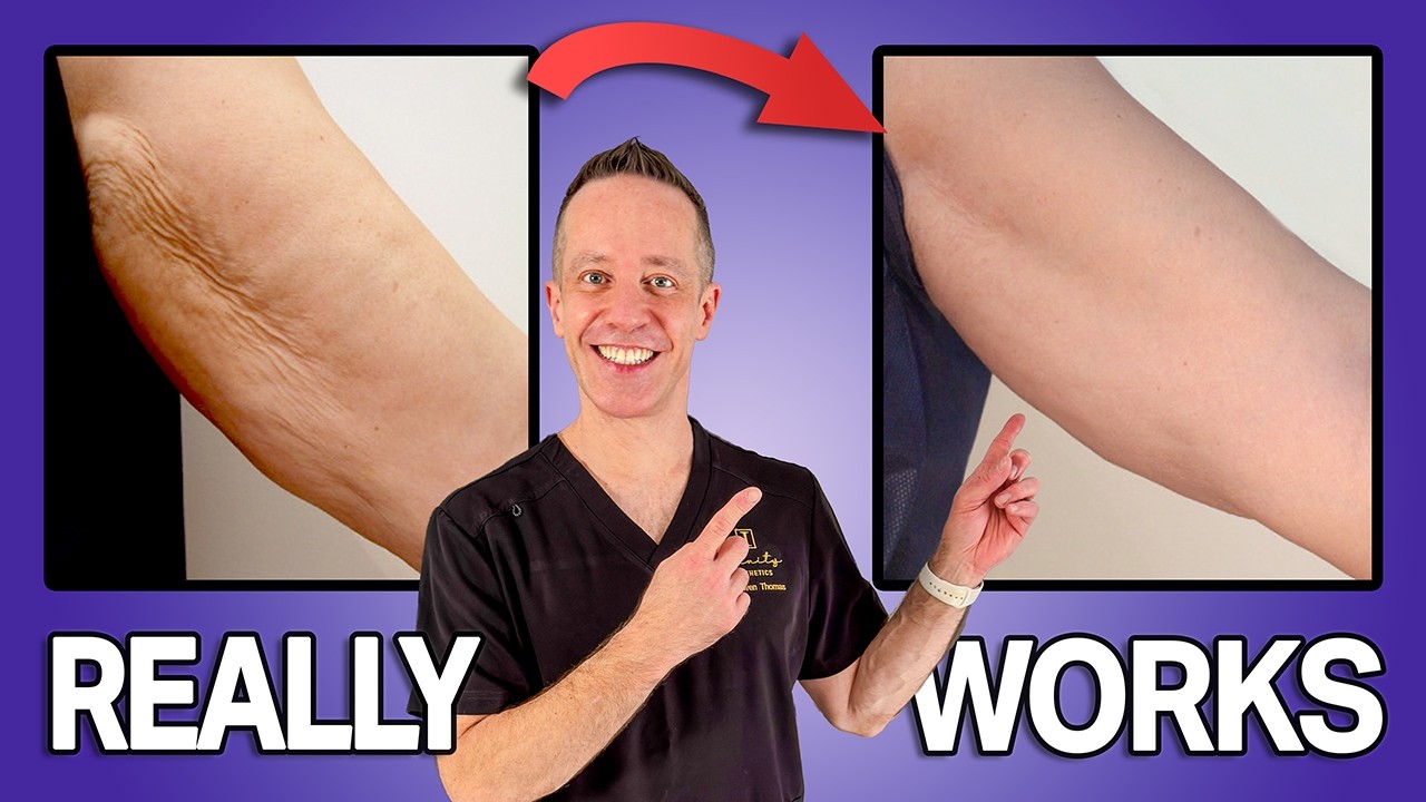 Точная формула от врача для устранения дряблости кожи после 40 лет