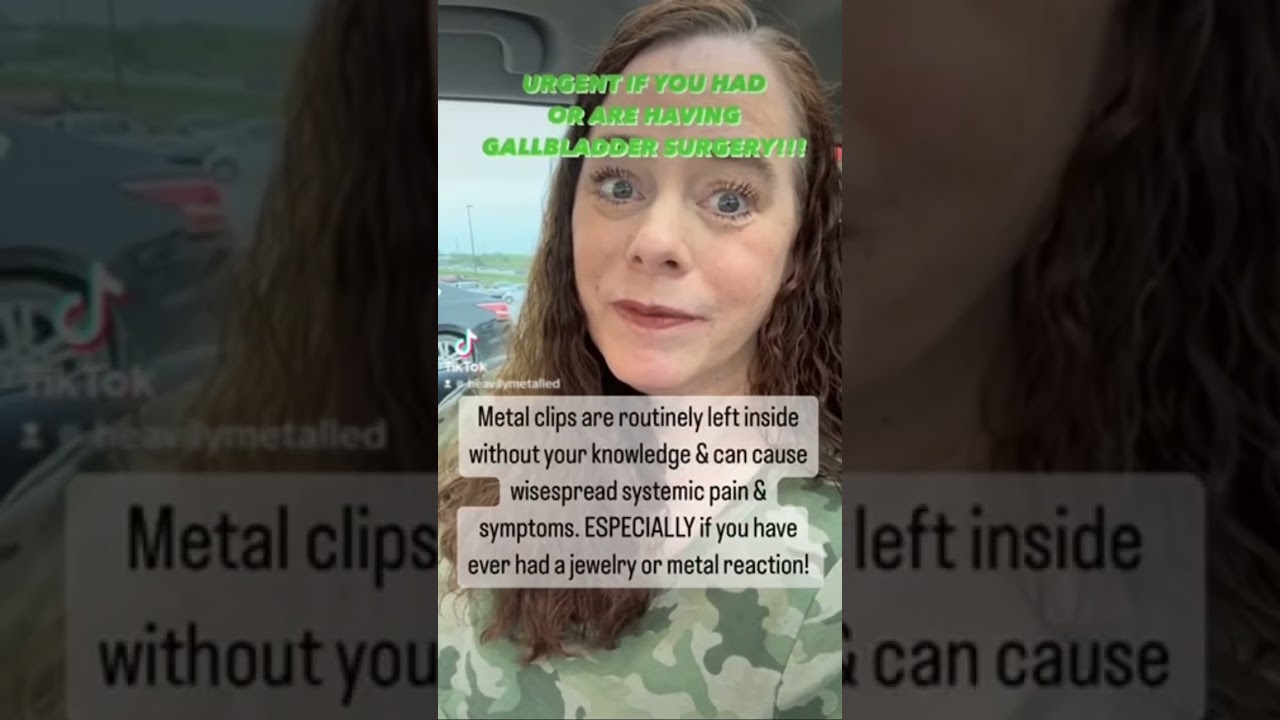 MUST KNOW for Gallbladder Surgery!