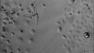 Keratinocytes and neuronal cells