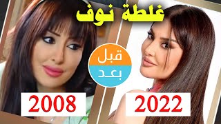 أبطال مسلسل غلطة نوف (2008) بعد 14 سنة .. قبل و بعد 2022 .. before and after