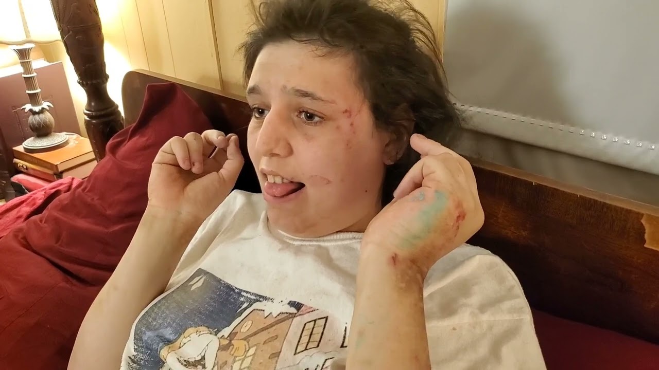 Тяжелый аутизм — у Мишель случился сильный срыв.