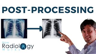 X-ray Post Processing (Filters, Histograms, VOIs)