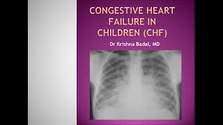 Congestive heart failure in children