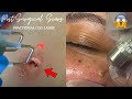 Most Extreme Beauty Treatments 2024 Best Smart and Helpful Beauty Hacks | Virtual Beauty