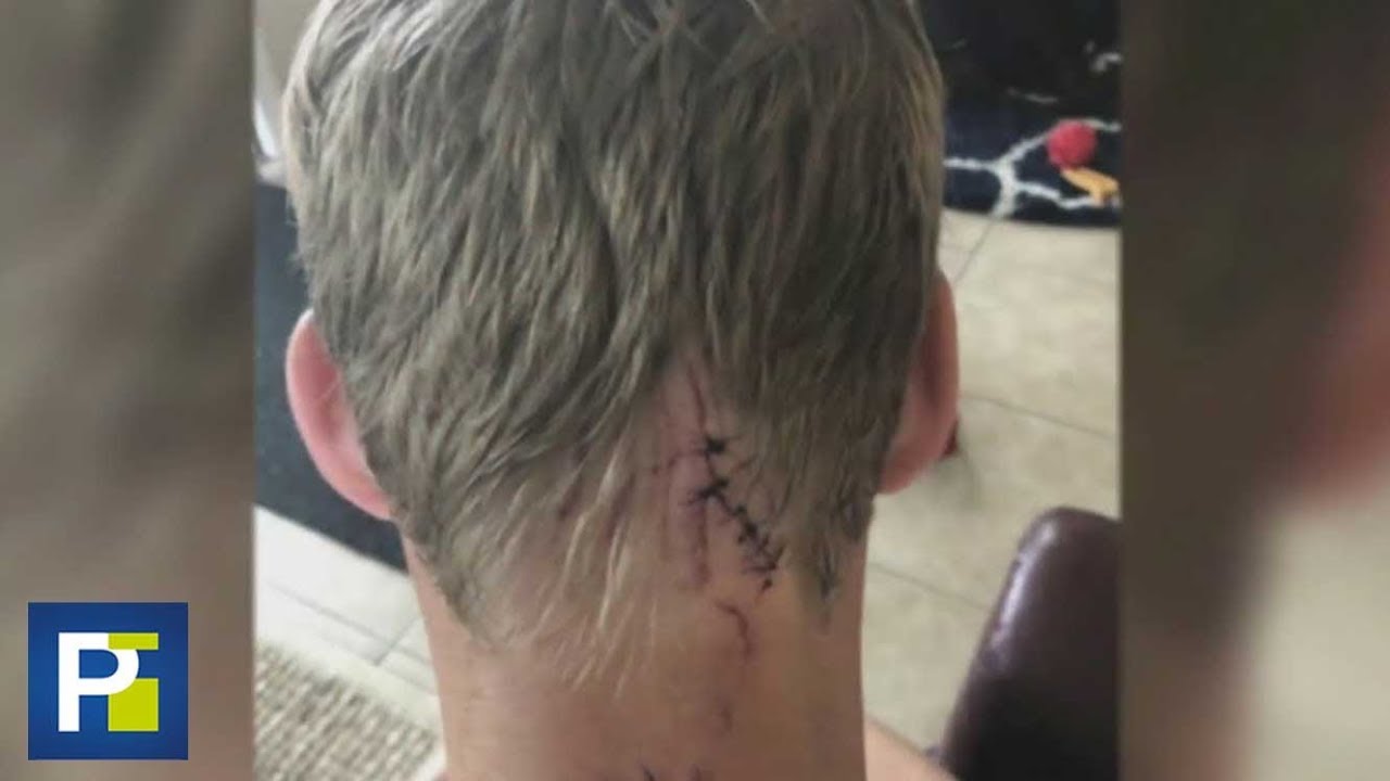 Buzo queda atrapado entre las fauces de un tiburón y vive para contarlo bahamas playas