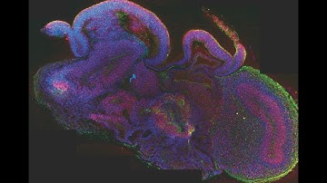 Science News - Brain organoid integrates into fetal mouse spinal cord, moves muscles