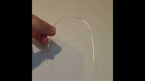 Braces Archwire | Stainless Steel (SS) | Align Braces Clinic