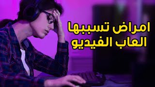 امراض تسببها العاب الفيديو؟ ?